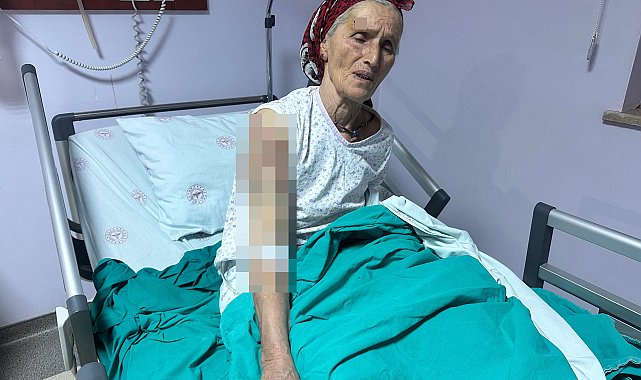 65 yaşındaki kadına 7 köpek saldırdı; vücuduna 50 dikiş atıldı