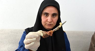 Ameliyatta karnında unutulan makas, 7 yıl sonra baş ağrısıyla ortaya çıktı