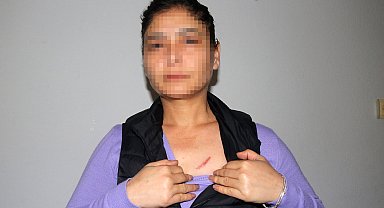 Daha önce evinin kapısını yaktığı kadını, elektrikli düzenekle öldürmeye çalıştı