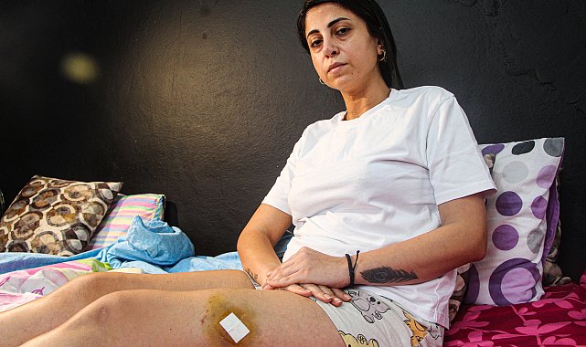 Çocuklarının önünde eski eşi tarafından vurulan Dilan: Yaşamak istiyorum