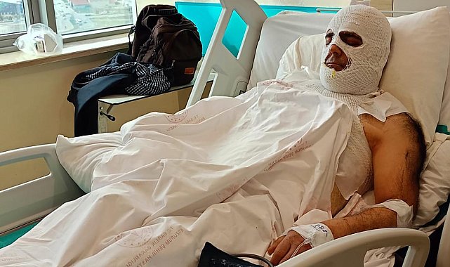 Yüksek gerilim akımına kapılan işçi 42 gündür hastanede