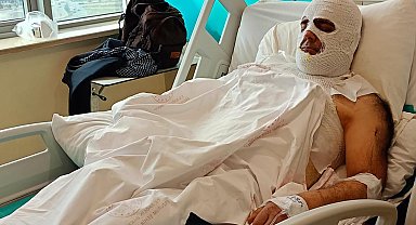 Yüksek gerilim akımına kapılan işçi 42 gündür hastanede