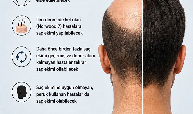 'Saç klonlaması, tedavide yeni bir çağın kapısını aralıyor'