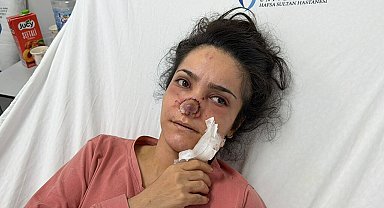 Eşi tarafından burnu ısırılıp koparılan İmran: Canımın acıyla balkondan atlamayı bile düşündüm