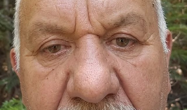 Tarladaki yangını söndürmeye çalışırken hayatını kaybetti